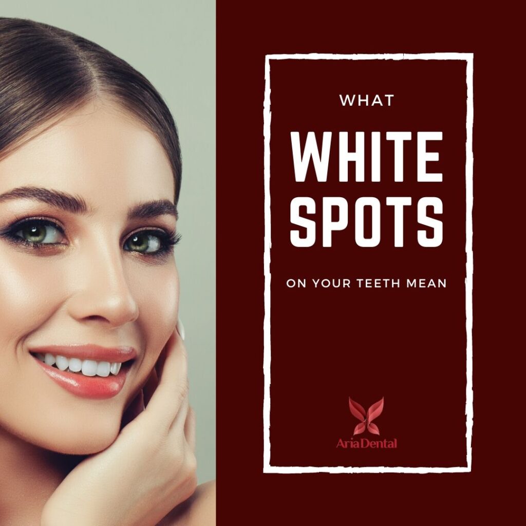 Visit-a-Dentist-in-Laguna-Niguel-for-White-Spots-on-Your-Teeth
