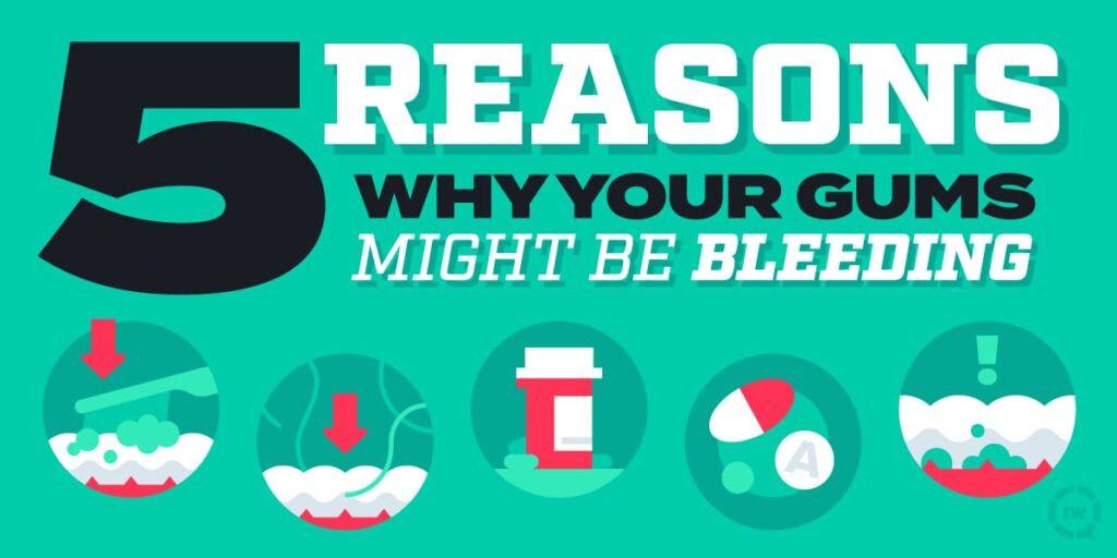 5 reasons why your gums might be bleeding