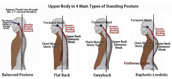 body-posture-depends-on-teeth