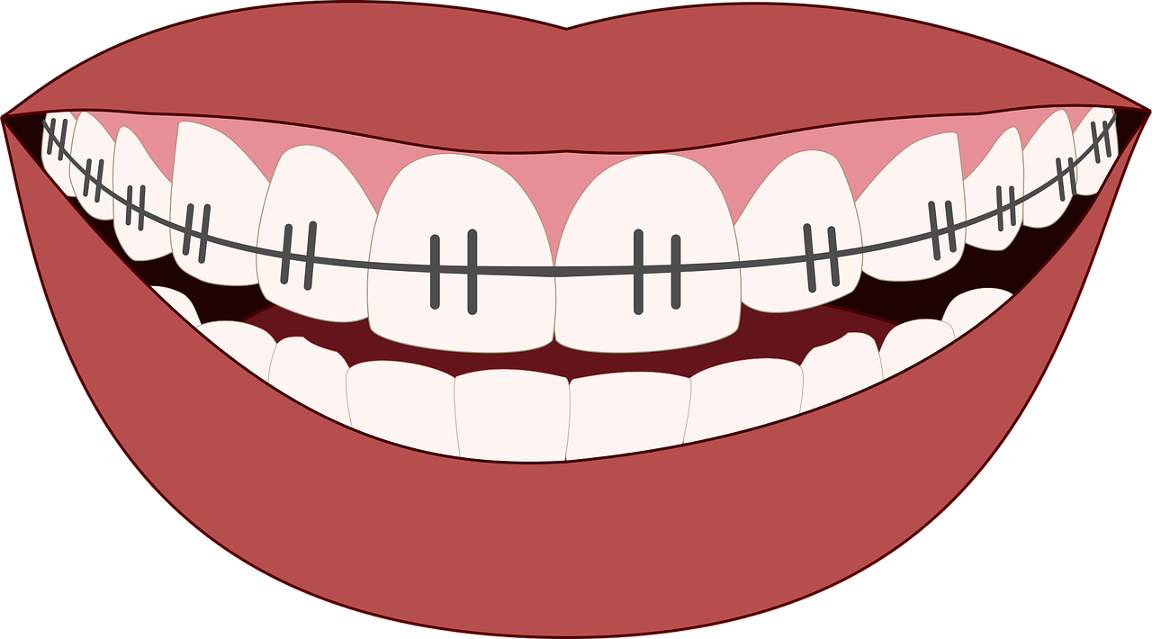 Orthodontics Insurance