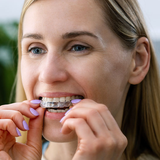 adult braces Invisalign

