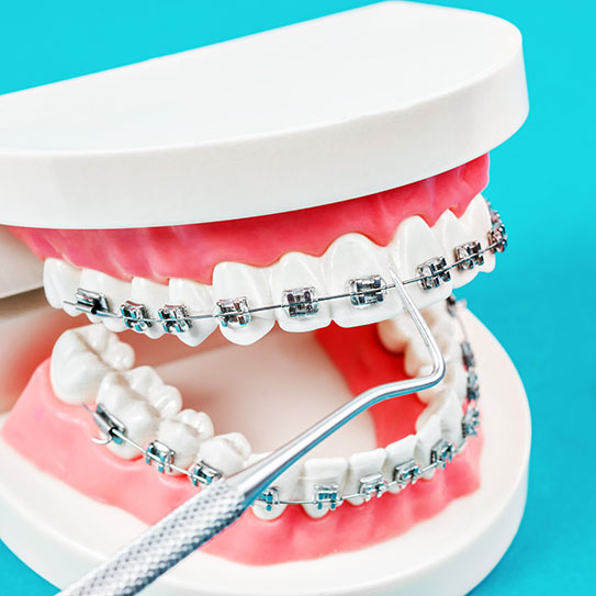 orthodontist near me for braces in Woodside