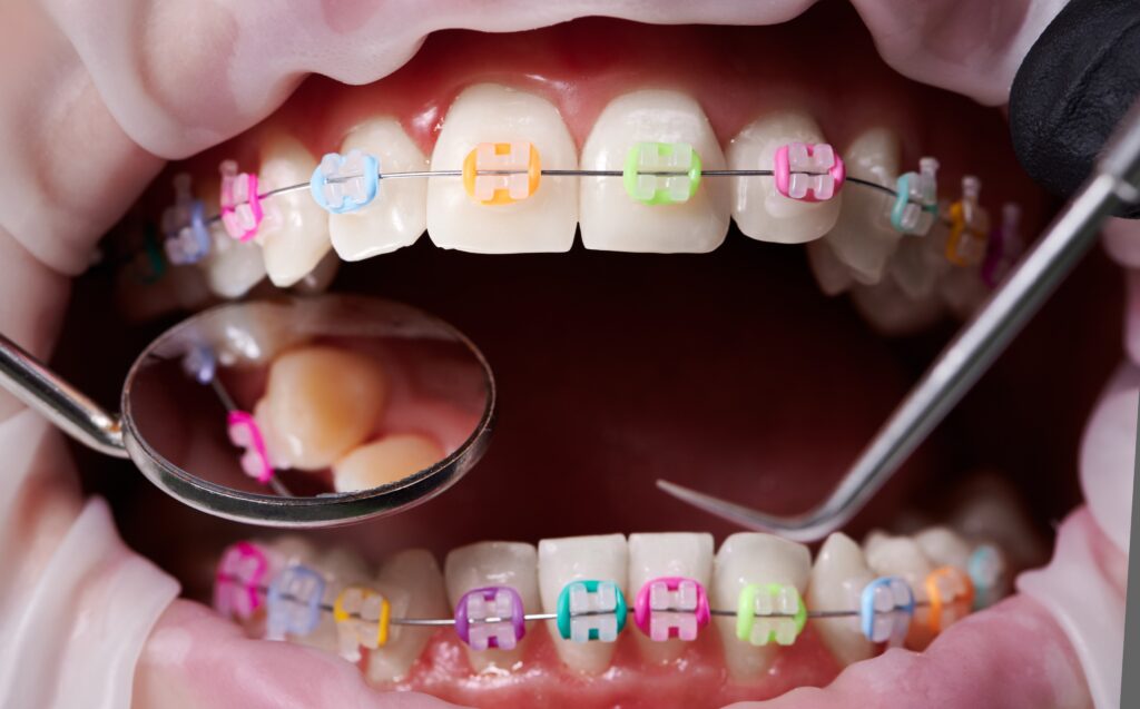 braces near me orthodontist in Queens NY