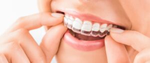 Braces Guide: Should I Wear My Retainer if It's Tight?