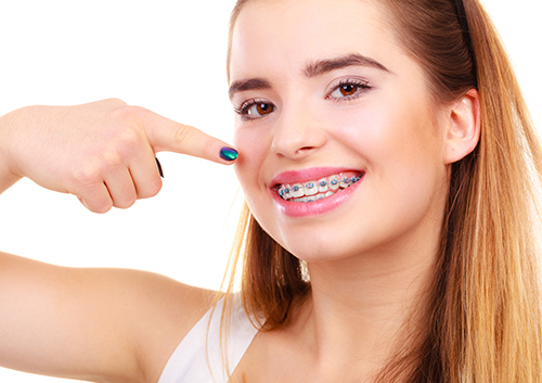 strongest rubber bands for braces