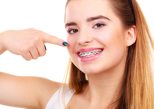 Have You Heard of DIY Braces? Orthodontists Warn Against It