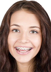 Teenager with braces