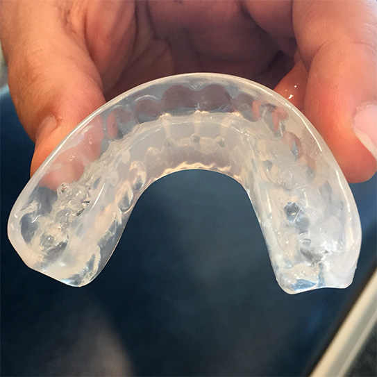 Perfect Your Bite With A Tooth Positioner