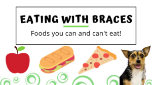 What are the foods you can t eat with braces Foods You Can And Can T Eat With Braces