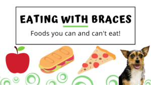 Foods you Can and Can’t Eat With Braces