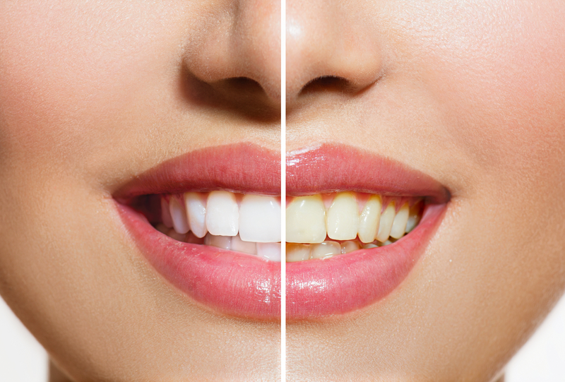 what whitening toothpaste actually works