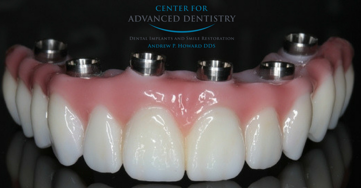 Our Blog Center For Advanced Dentistry Loveland Co