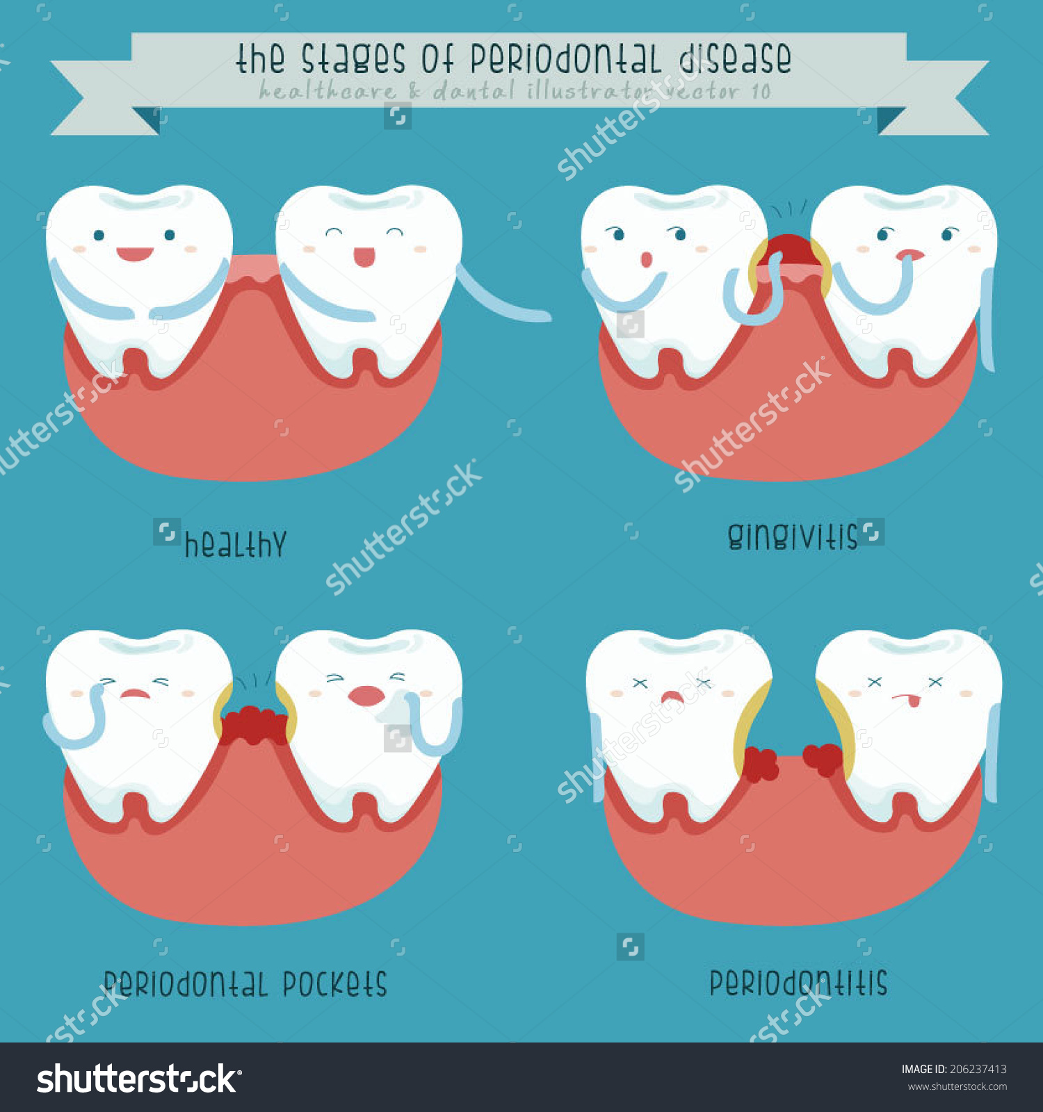 Gingivitis vs. periodontitis: what’s the difference?