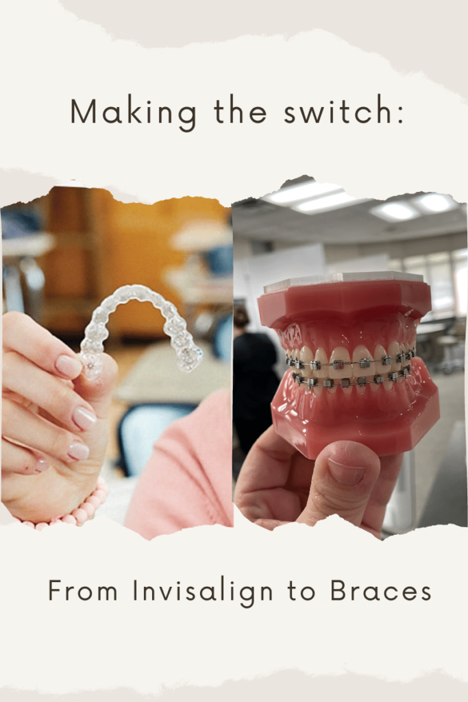 Making The Switch: From Invisalign to Braces