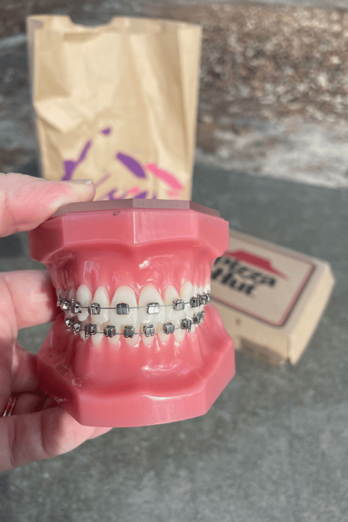 photo of picnic table showing a model of braces with fast food bags in the background