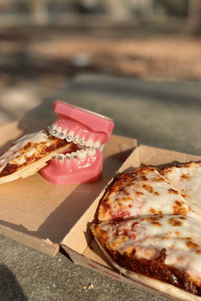 model of braces biting into pizza