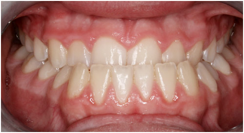 Oshawa Orthodontists  Orthodontics and Invisalign in Oshawa, ON