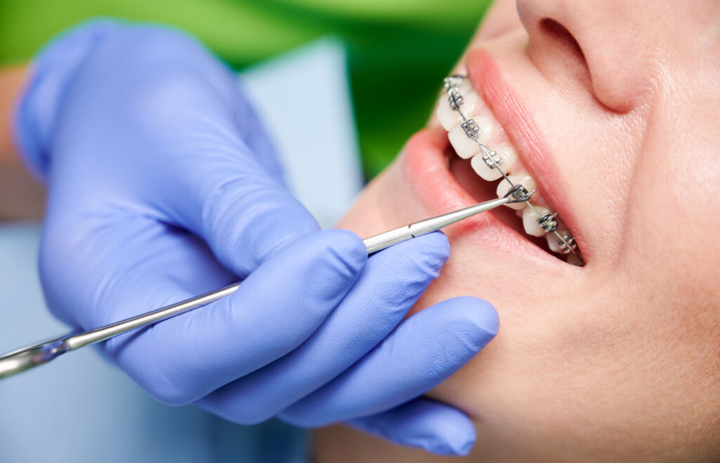orthodontist in Toledo, Ohio