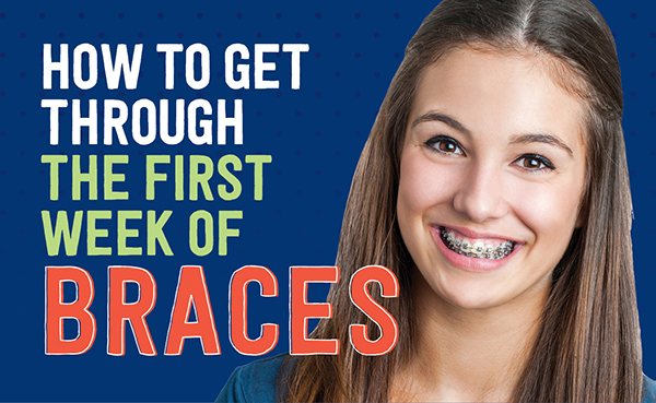first week with braces