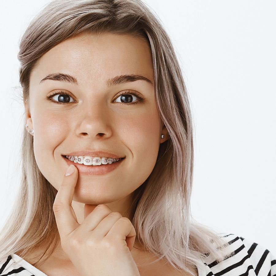 Understanding How Long You'll Wear Braces