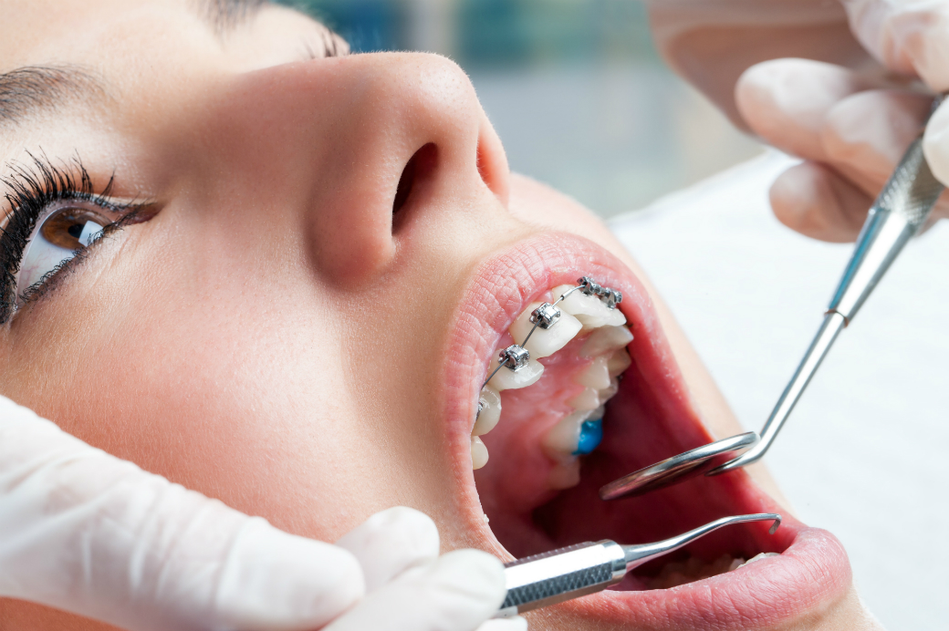 orthodontist treatment dental services