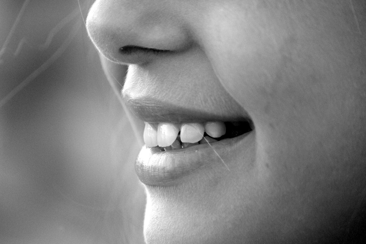 white teeth braces