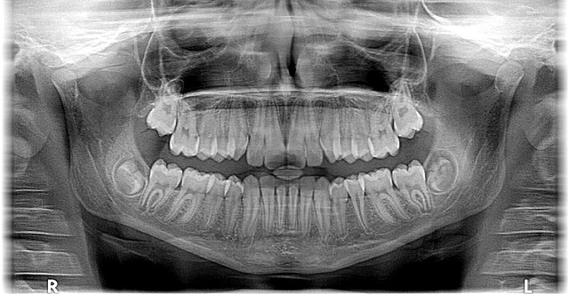dentist braces