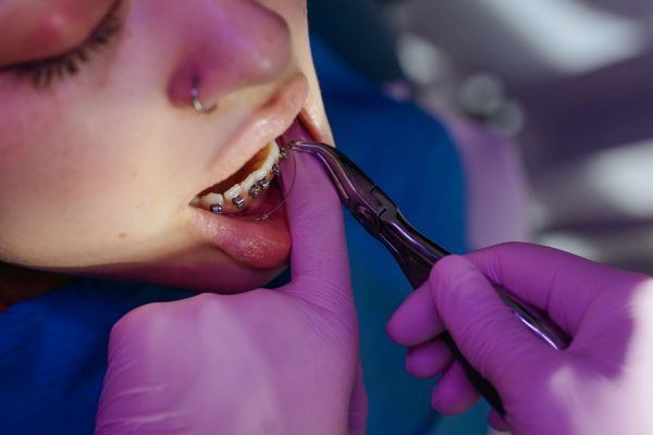 How to Financially “Brace” for Orthodontia