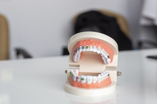 best orthodontist Tyler TX