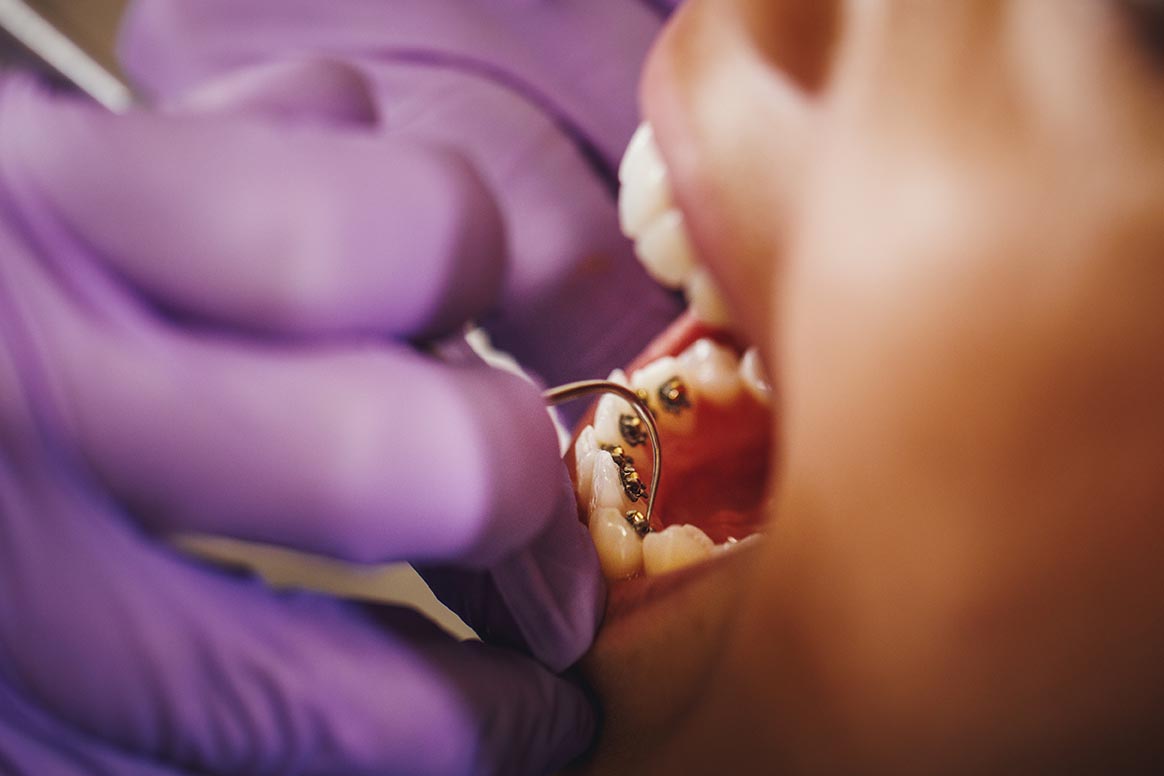 Arkansas Braces being examined by an orthodontist